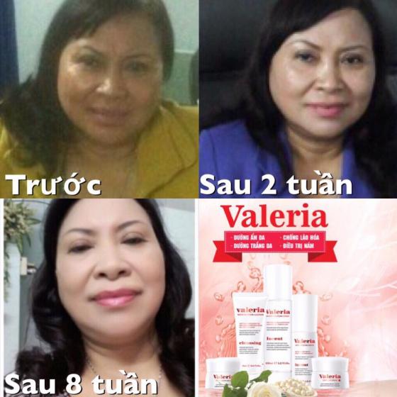 Cô ấy sử dụng Valeria sau 8 tuần